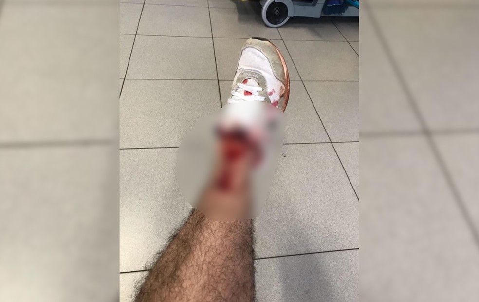 Homem cai em bueiro sem proteção em Bauru e quebra duas costelas — Foto: Arquivo Pessoal