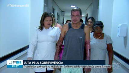 Trabalhador queimado no incêndio de Buritirana deixa hospital após quase 5 meses