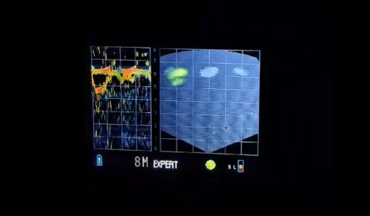 PM usou equipamento com mapa de calor para ver que secretário de Osasco já tinha sido morto por GCM