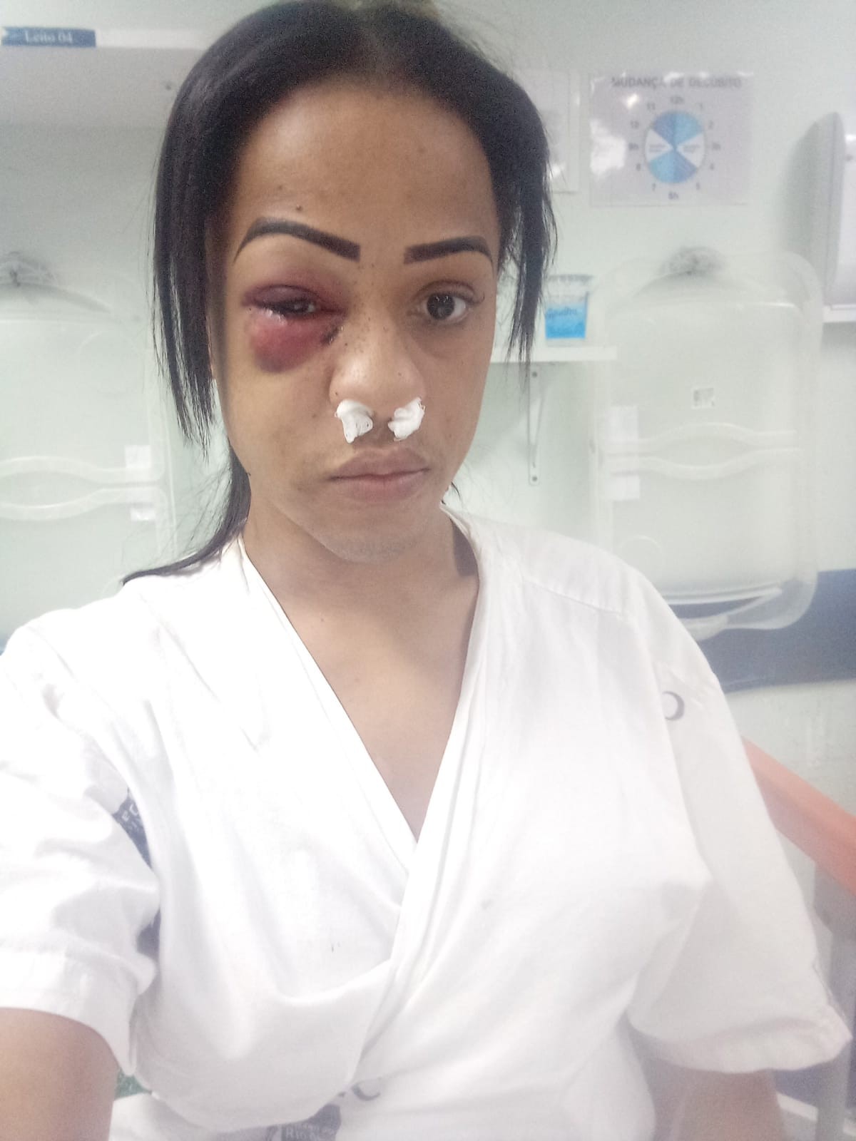 Com bala alojada no rosto, mulher trans relata que sofreu tentativa de  homicídio após ser alvo de homofobia e intolerância religiosa | Rio de  Janeiro | G1