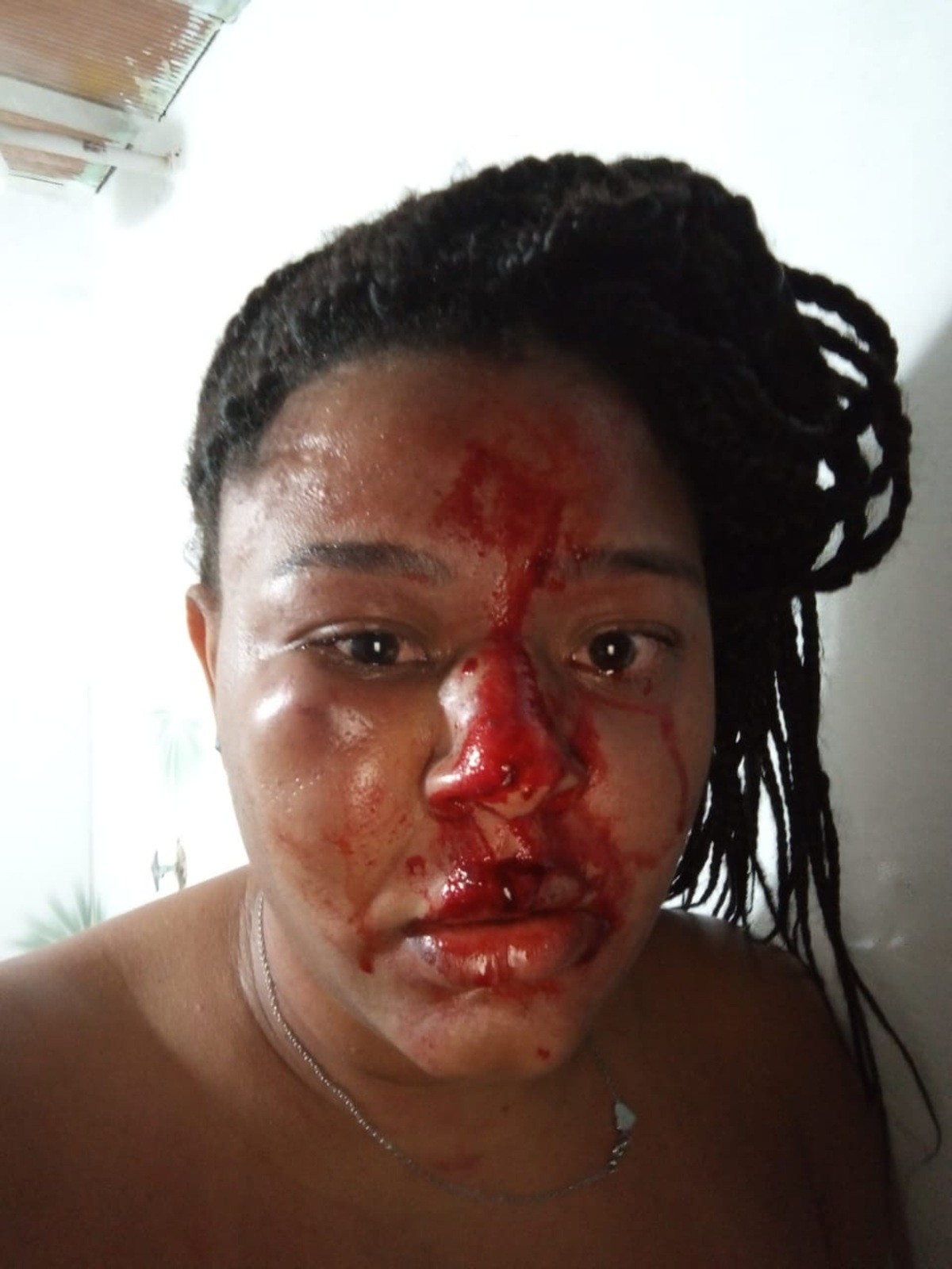 Mulher é agredida pelo ex-companheiro dentro de casa em Araruama