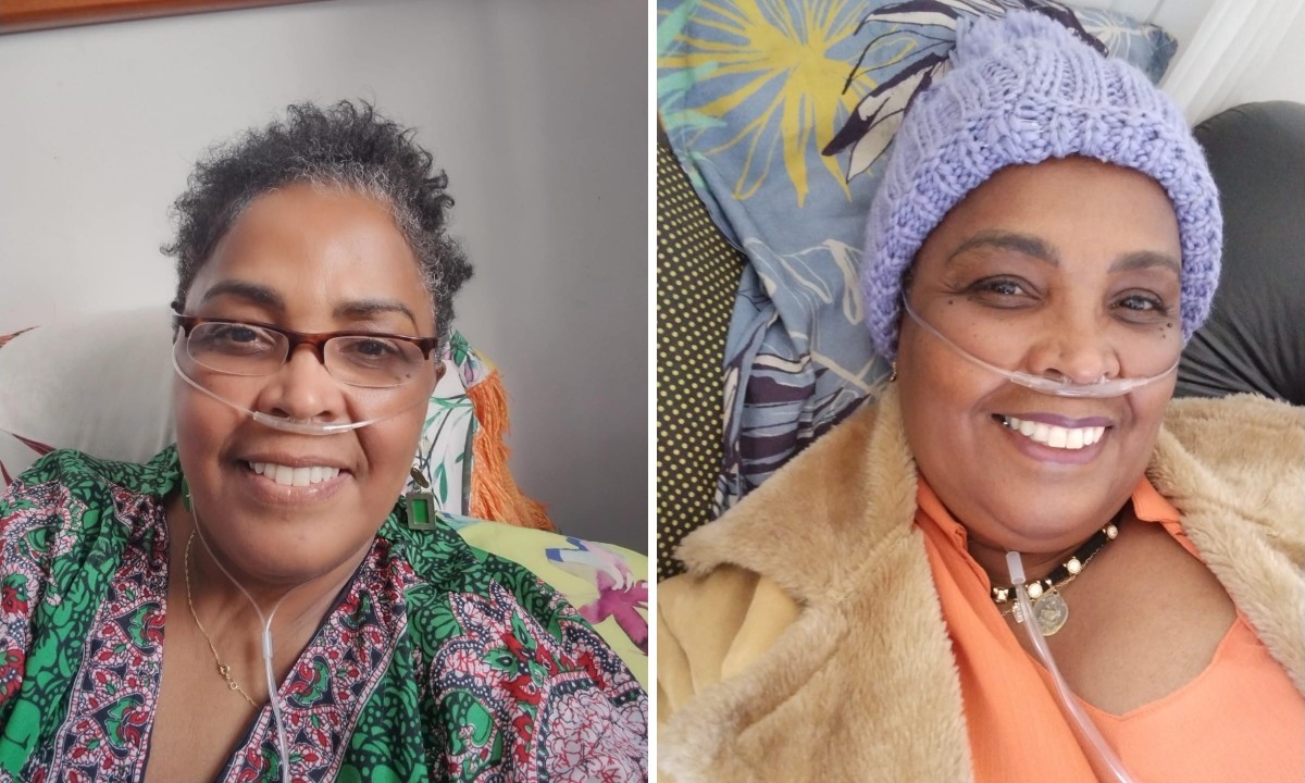 Mulher descobre doença autoimune que atrofia os pulmões após 11 anos de sintomas: 'Me canso até para tomar banho'