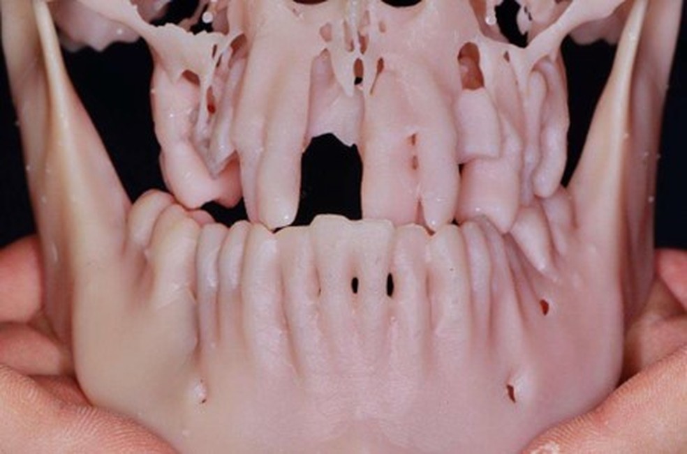 Reprodução dos dentes de D. Leopoldina — Foto: Reprodução
