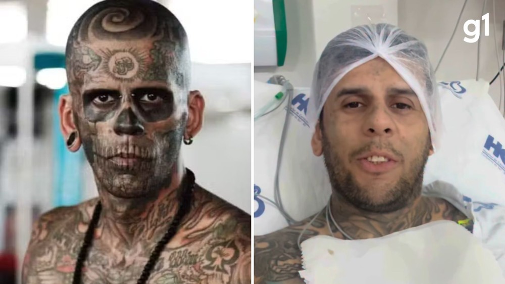Homem mais tatuado do Brasil passará por quimioterapia e cirurgia para tratar câncer de bexiga