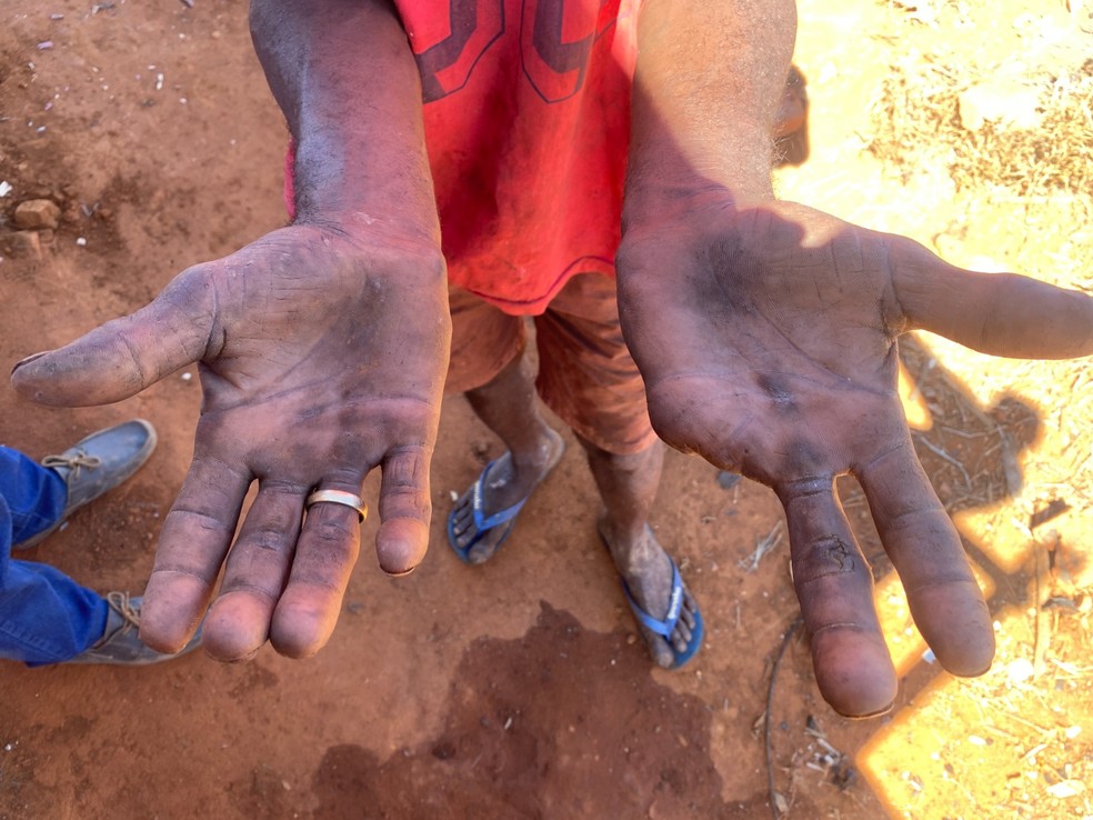 Homem perdeu dois dedos no trabalho — Foto: MTE