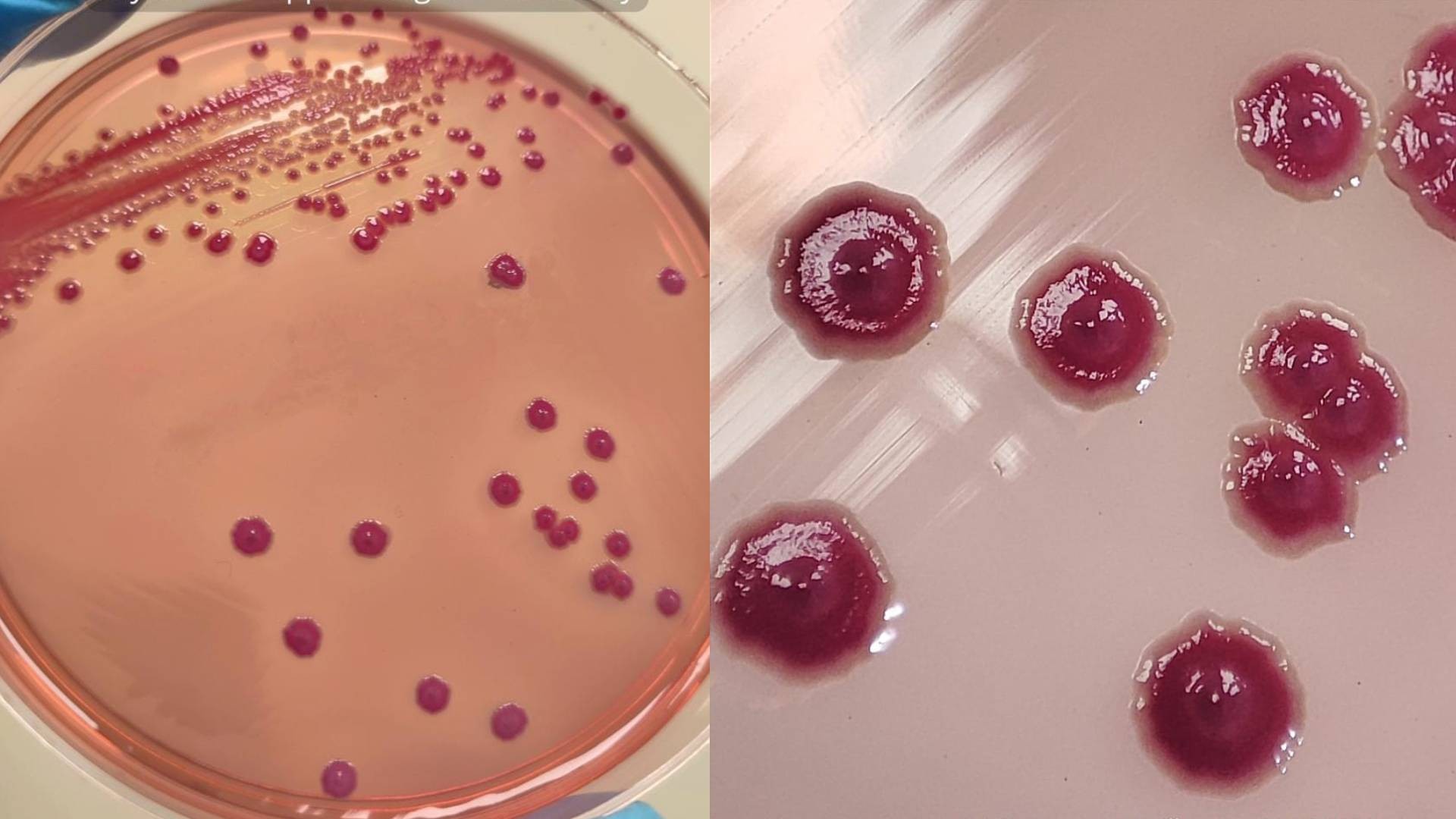 Bactéria 'disfarçada' pode ainda ser confundida em exames mesmo depois de surto que matou 15 bebês