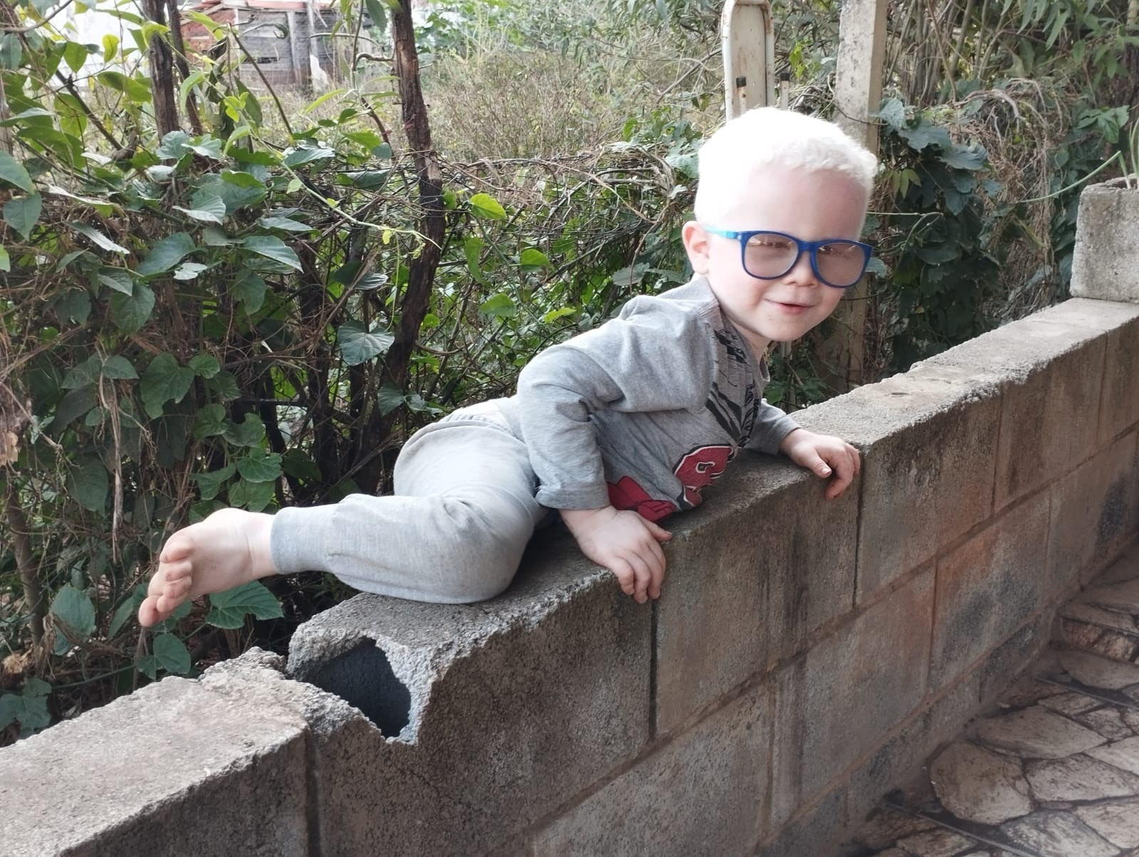 Mãe de filho albino diz que ainda sofre com falta de protetores solares gratuitos: 'É como um medicamento de uso contínuo'