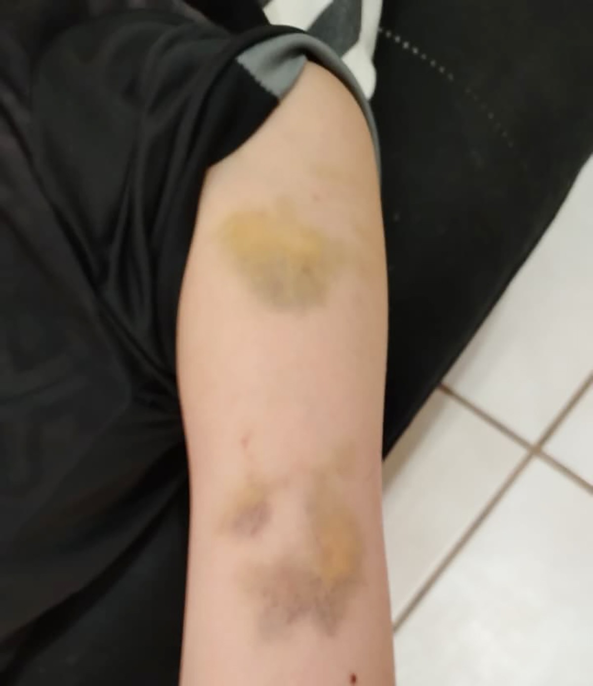 Polícia investiga denúncia de agressão de professores a aluno em surto em escola de Piracicaba
