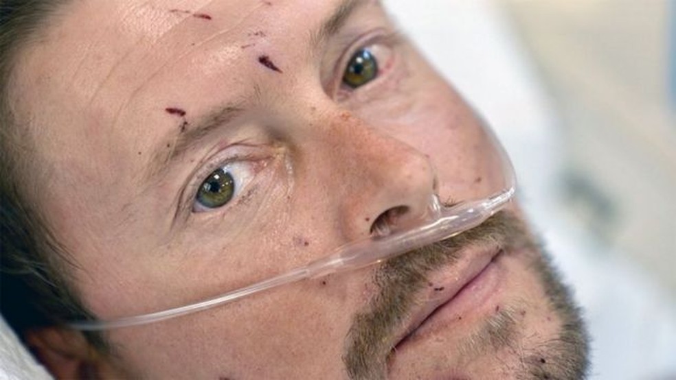 Oleksii perdeu ambas pernas em uma explosão. — Foto: Goktay Koraltan/ BBC