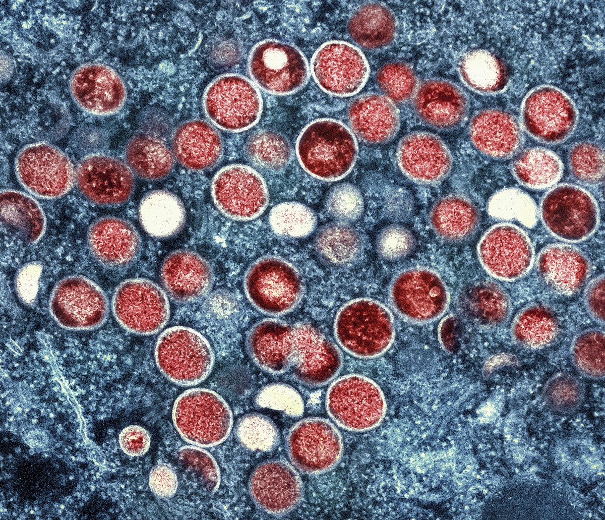 Estado de SP registra 315 casos de Mpox entre janeiro e julho de 2024; alta de 257% em relação ao ano anterior | São Paulo | G1
