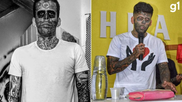 contioutra.com - ANTES E DEPOIS CHOCANTE: 'Mais tatuado do Brasil' aparece quase sem marcas após 5ª sessão a laser no rosto