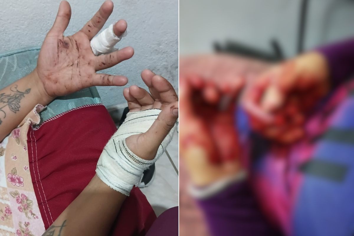 Homem esfaqueia e tenta estrangular ex no interior de SP; vítima tinha medida protetiva