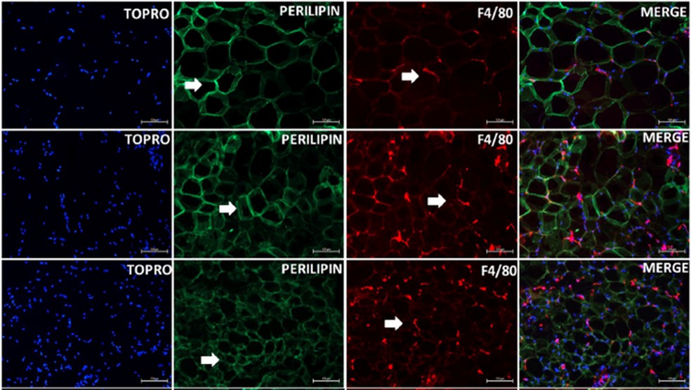 Imagem microscópica do tecido adiposo branco dos camundongos controle (CV) e os suplementados com óleo de coco em duas doses diferentes (CO100 e CO300). m azul a marcação identificando núcleo celular (TROPO), em verde a marcação da perilipina marcando a célula adiposa e em vermelho a marcação (F4/80) que indica o aumento da presença de macrófagos no tecido adiposo. — Foto: Marcio Alberto Torsoni