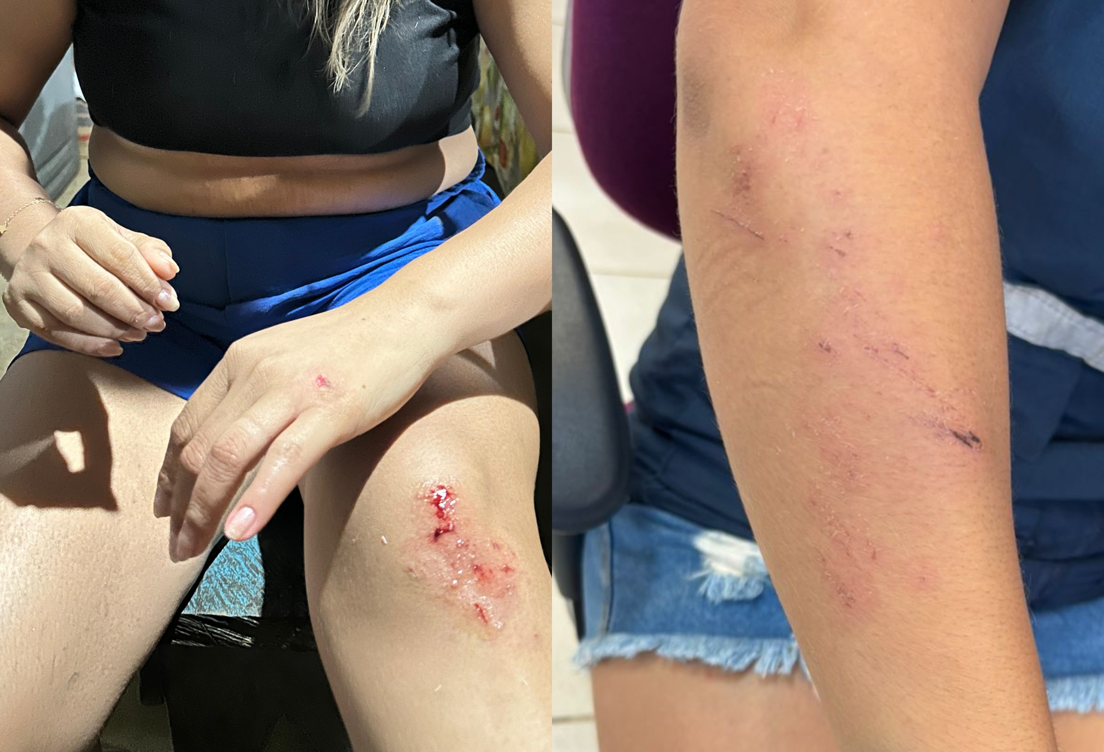 Técnica é atacada e ameaçada em polo de saúde na Terra Yanomami; Ministério retira equipe do local