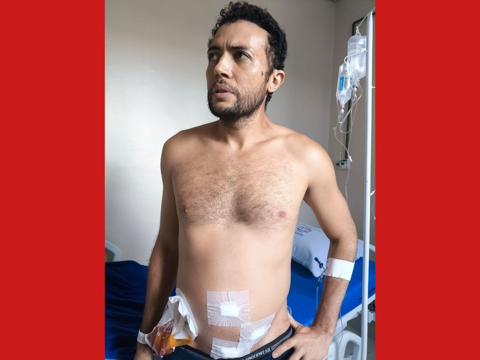 Professor passa por cirurgia de urgência de apendicite e esposa aponta negligência em atendimentos no AC: 'Diziam que eram gases'