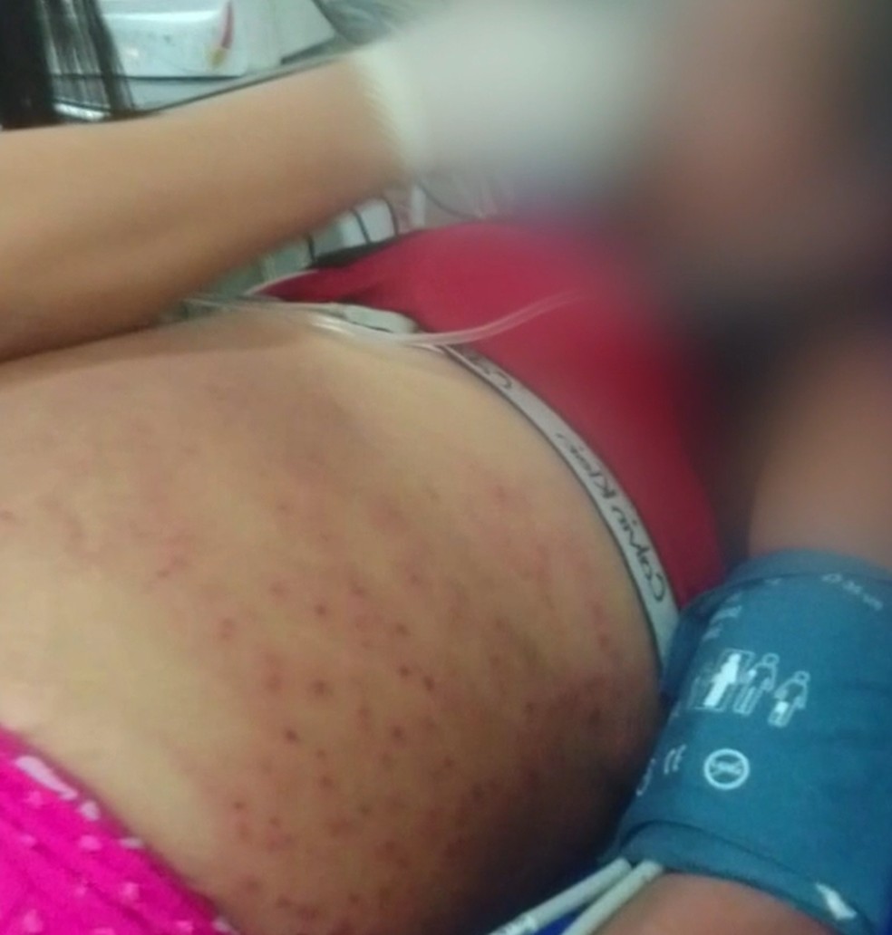 Mulher sofreu mais de 1 mil picadas de abelhas, segundo laudo médico — Foto: Divulgação