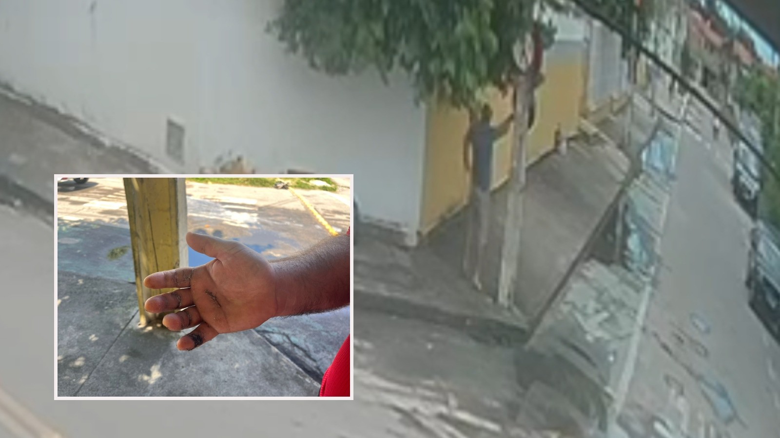 Homem que sofreu choque elétrico em placa de sinalização perdeu parte do movimento da mão
