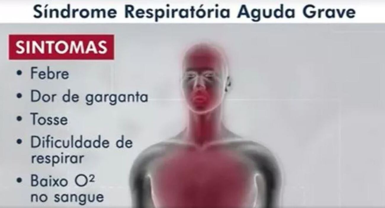 Síndrome respiratória aguda grave mata 3 crianças e 9 adultos em 5 meses em São João; veja sintomas