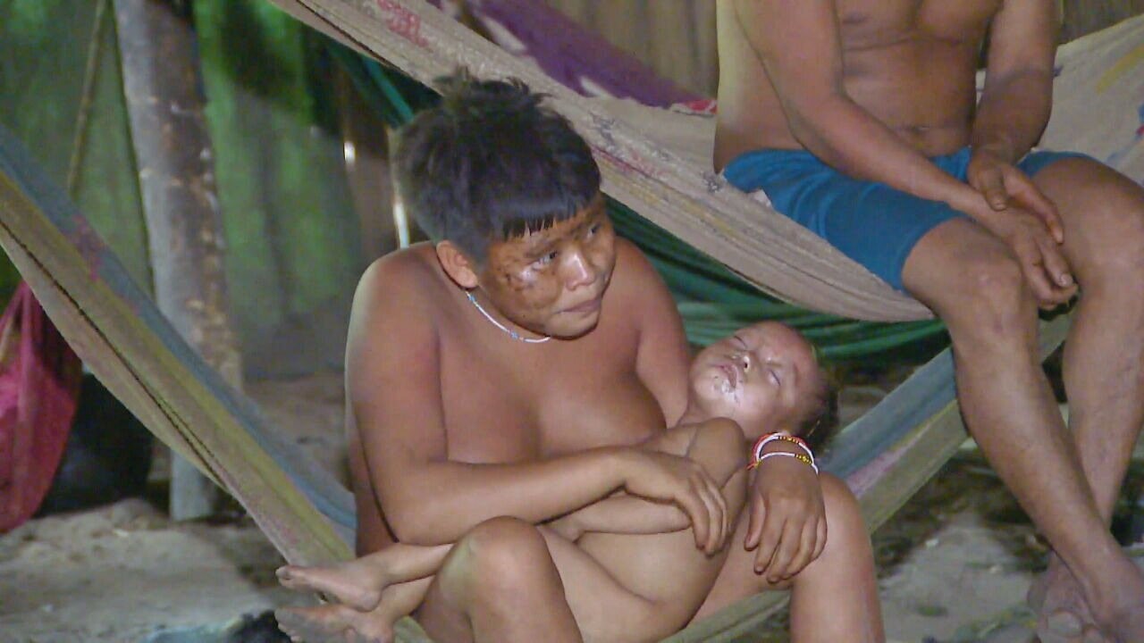 Crianças ianomâmi sofrem com desnutrição e falta de atendimento médico