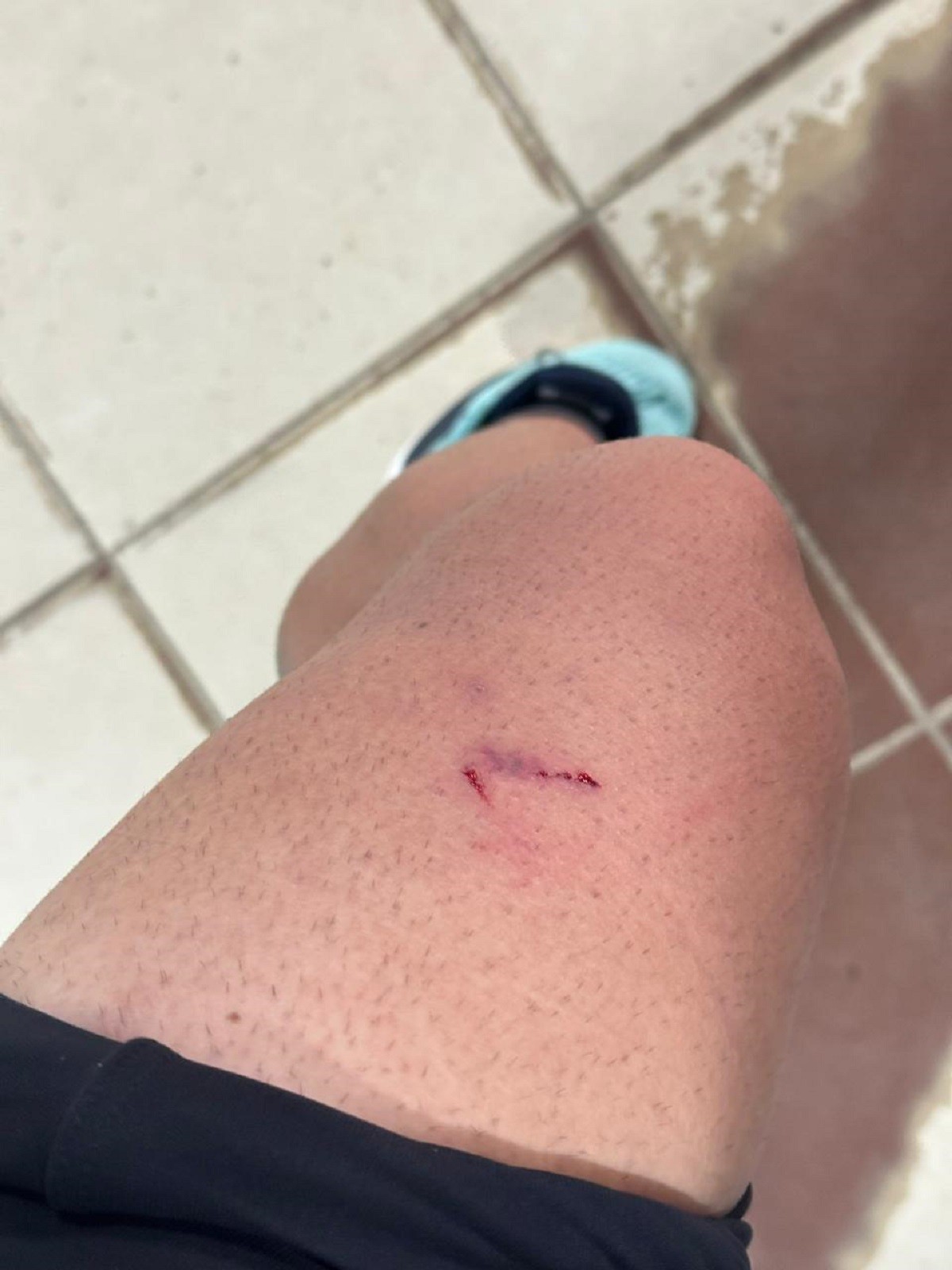 VÍDEO: Corredor é perseguido por cachorros durante treino e viraliza;  'Vou ter que correr mais rápido'