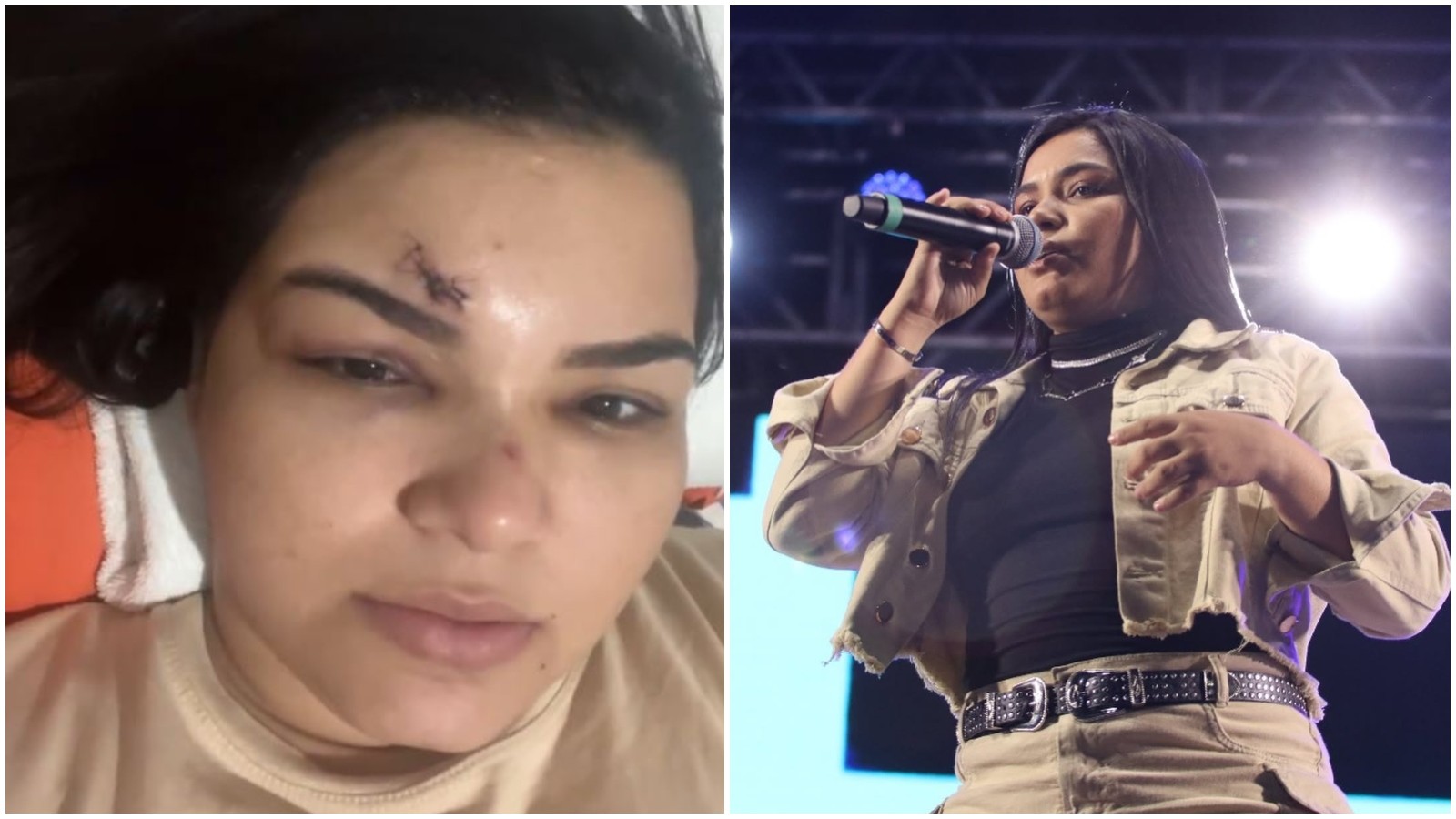 Cantora que teve testa cortada com golpe de garrafa denuncia agressoras: 'Não entendi por que elas me bateram'