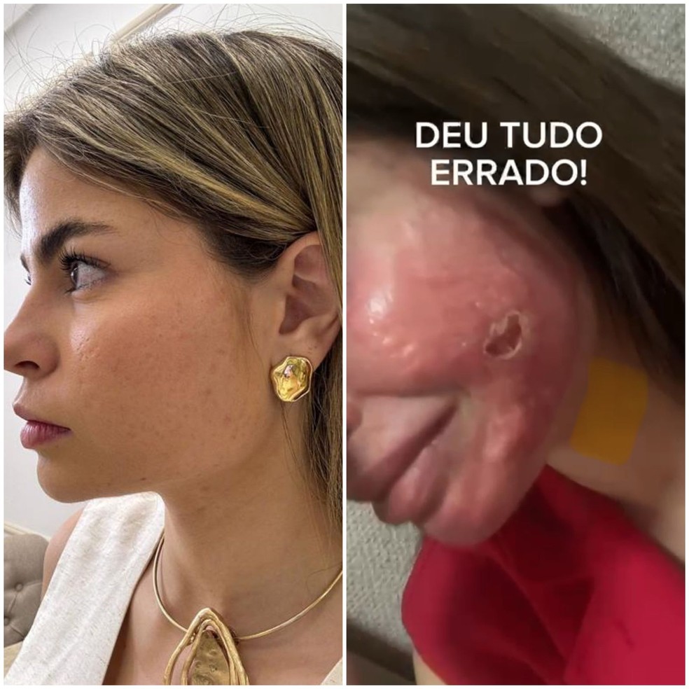 Arte mostra rosto de médica antes e depois de apresentar reações a procedimento — Foto: Arquivo Pessoal/Arte g1