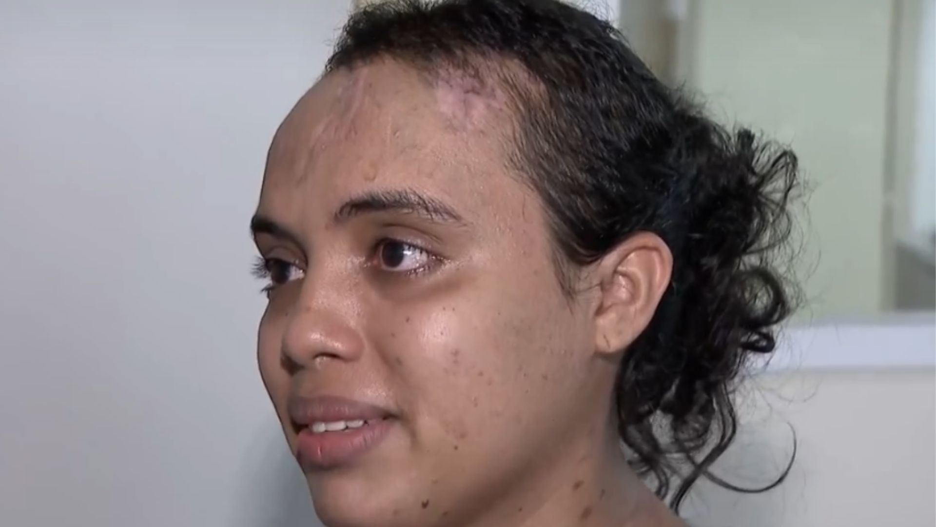 Dois meses após tragédia com ônibus na MG-223, bebê nascida em parto de emergência recebe alta: ‘Aurora é o recomeço’