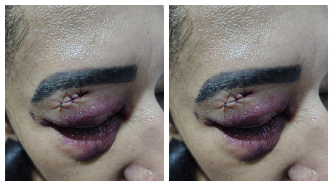 Vídeo: Mulher se joga de carro em movimento após ser esfaqueada pelo ex em Osasco, na Grande SP