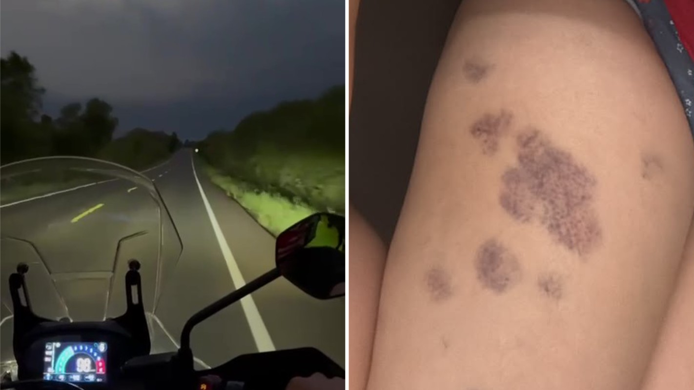 VÍDEO: Motociclistas ficam feridos após serem surpreendidos por granizo em rodovia no RS; grupo passou por supercélula