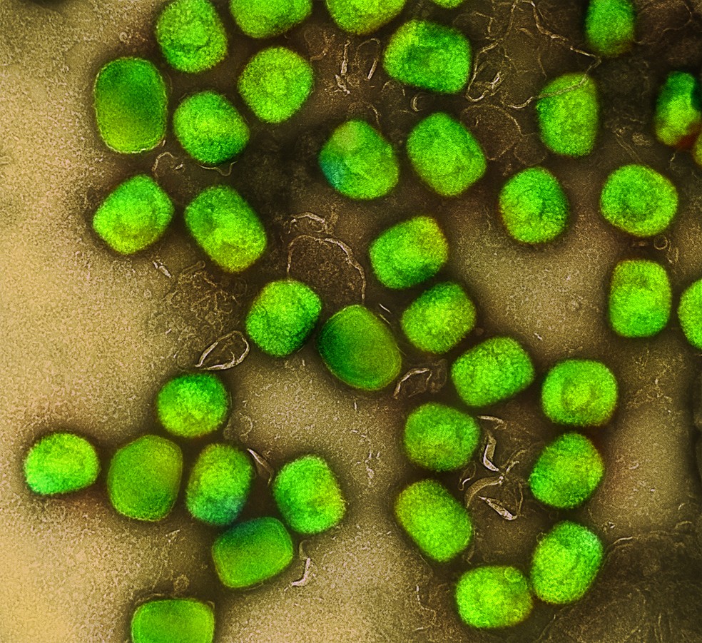 Part&iacute;culas do v&iacute;rus da mpox vistas em microsc&oacute;pio eletr&ocirc;nico. &mdash; Foto: NIAID