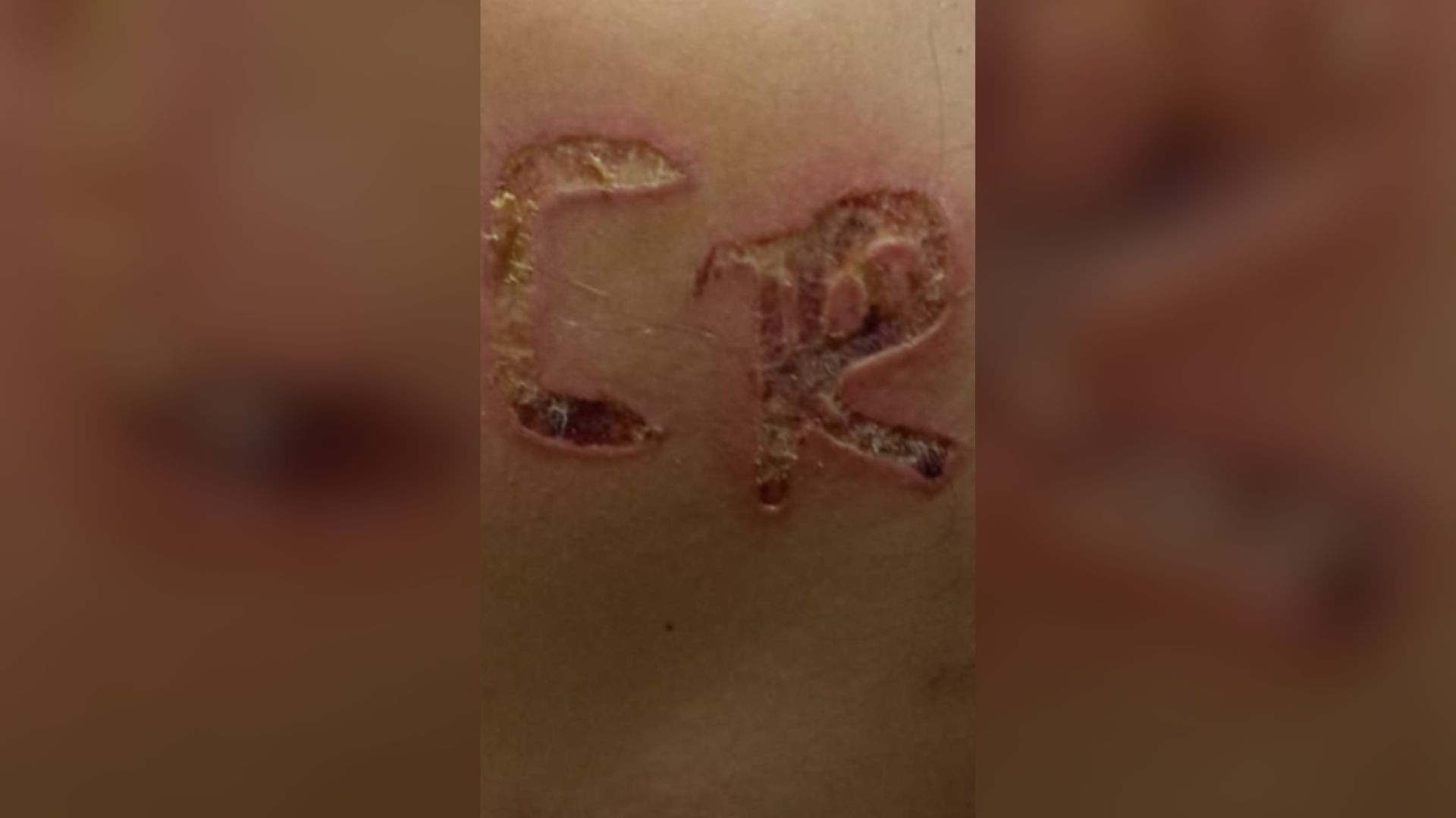 Marido preso por marcar iniciais no corpo da esposa em SP