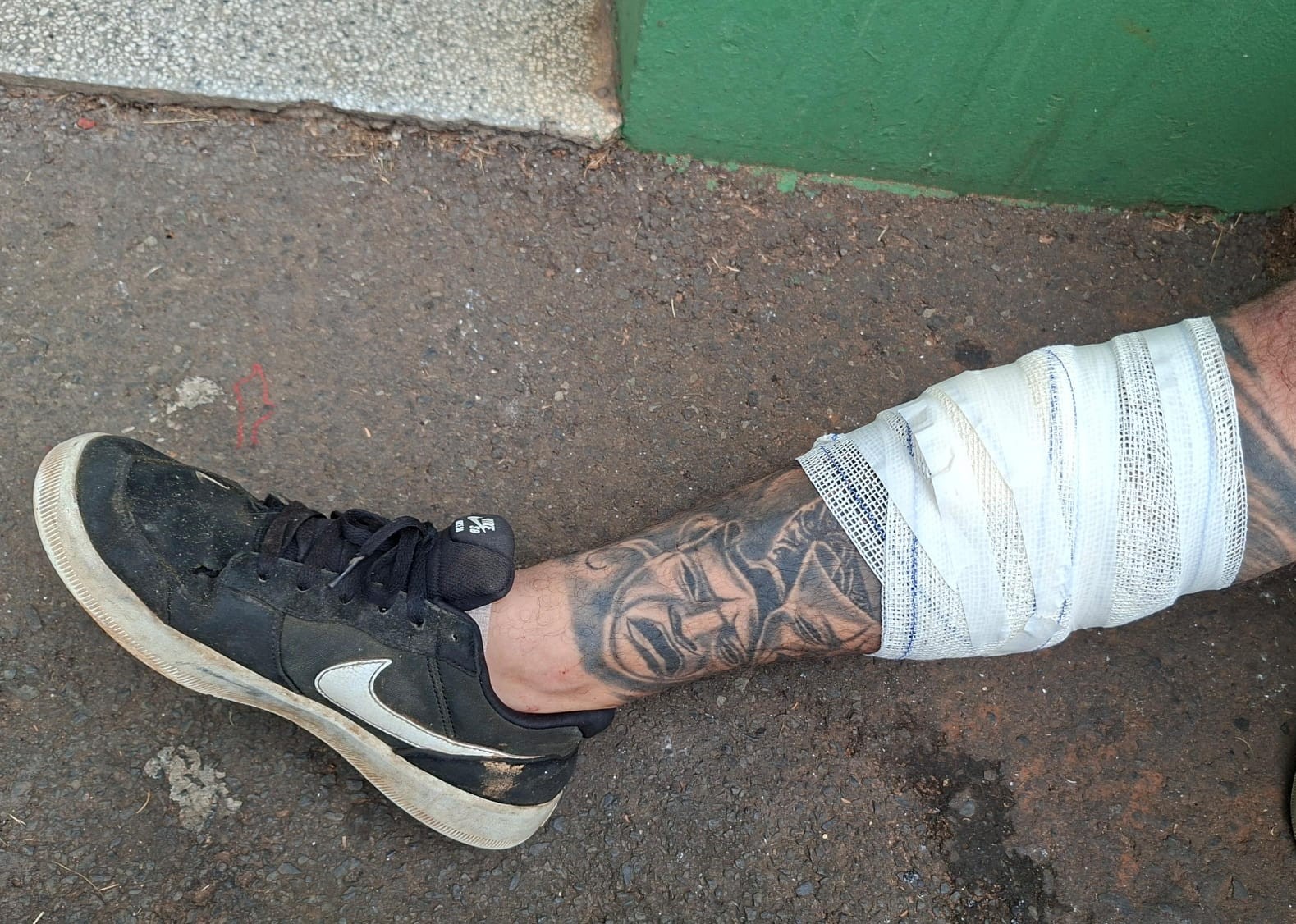 Secretaria de Meio Ambiente reforça necessidade de descarte adequado de lixo