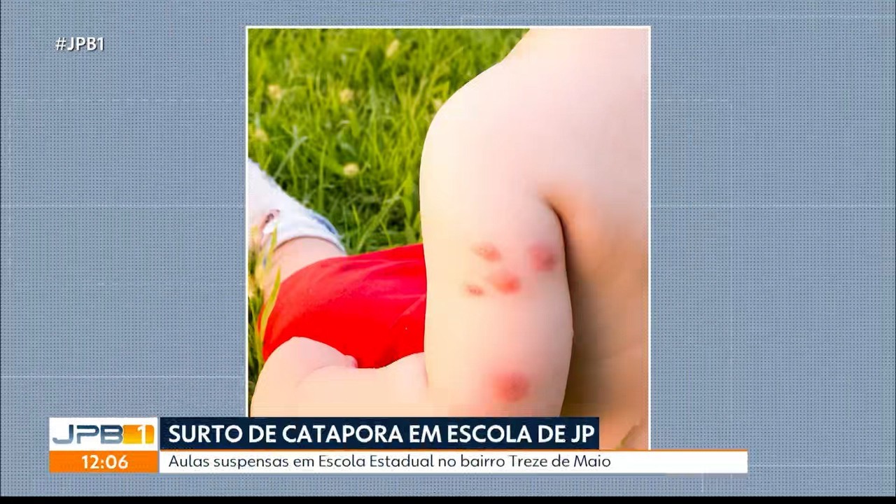 Aulas são suspensas após casos de catapora em escola de João Pessoa