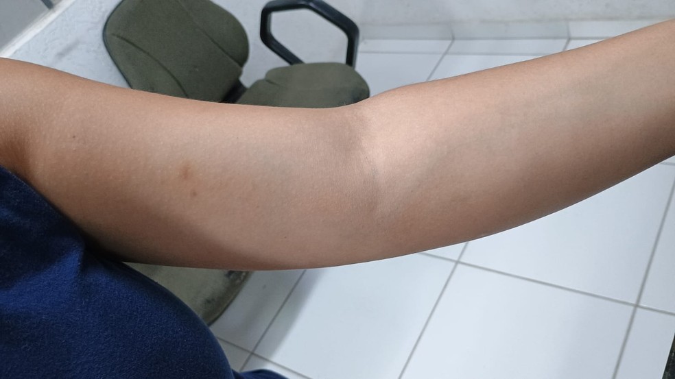 Vítima mostrou marcas causadas por agressões | Foto: PCPR