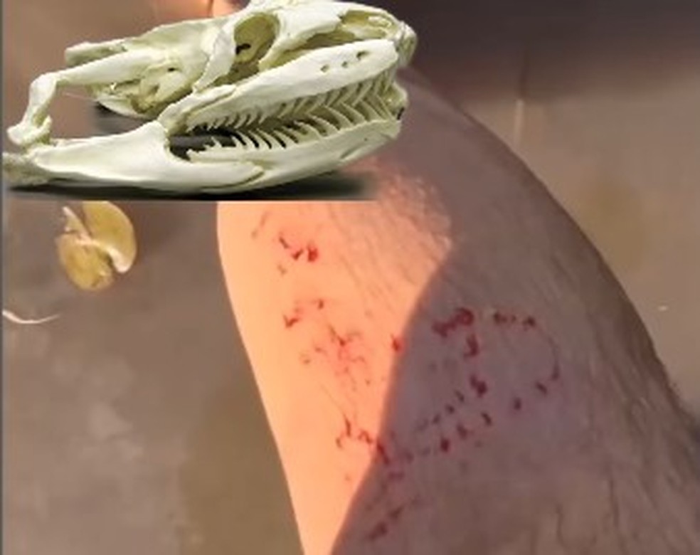 A mordida da sucuri foi analisada pelo biólogo e especialista em serpentes Henrique Abrahão Charles | Foto: Henrique Abrahão Charles e Rafael Gandine