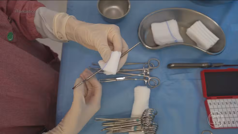 73% dos cirurgiões dizem que já operaram algum paciente para retirada de um corpo estranho, aponta levantamento da USP — Foto: Fantástico/ Reprodução