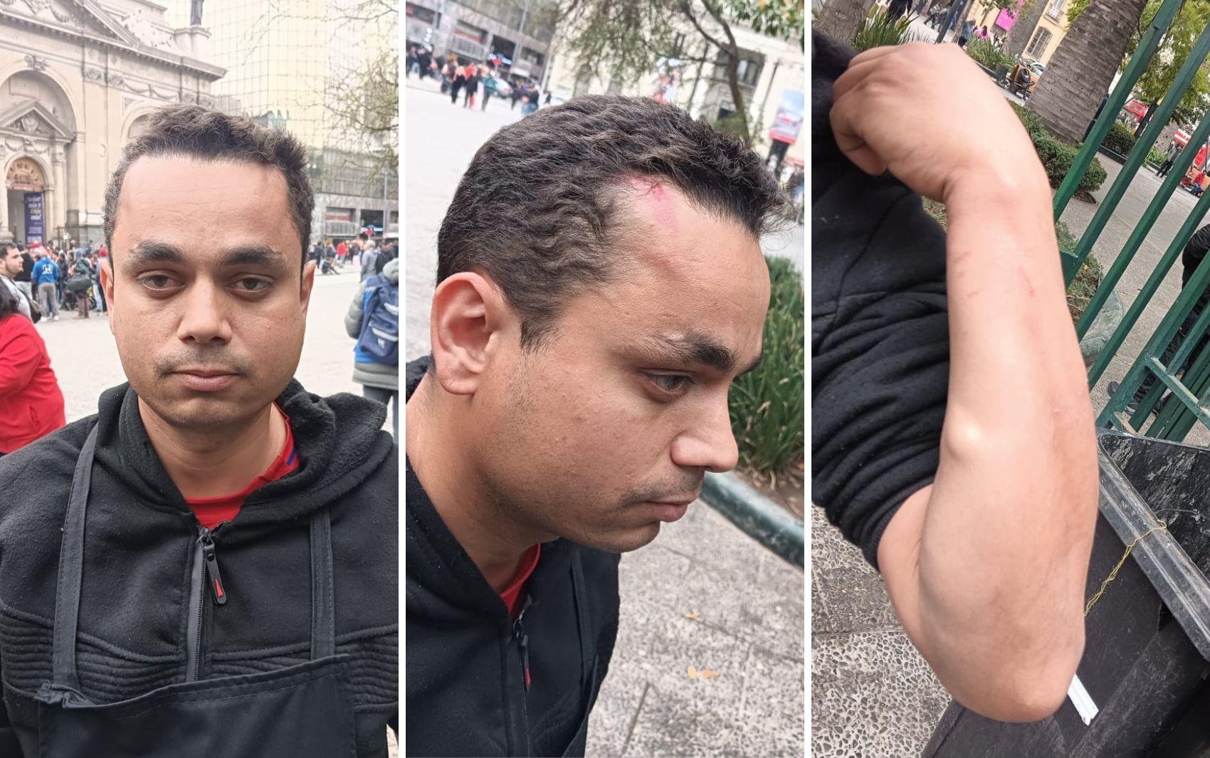 Brasileiro é espancado no Chile durante o primeiro dia de trabalho em restaurante, denuncia amigo