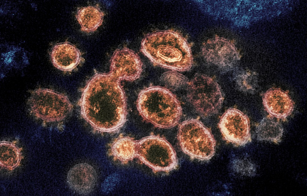 Imagens de microscópio mostram partículas do coronavírus que causam a Covid-19 retiradas de um paciente nos EUA — Foto: Arquivo/NIAID-RML via AP
