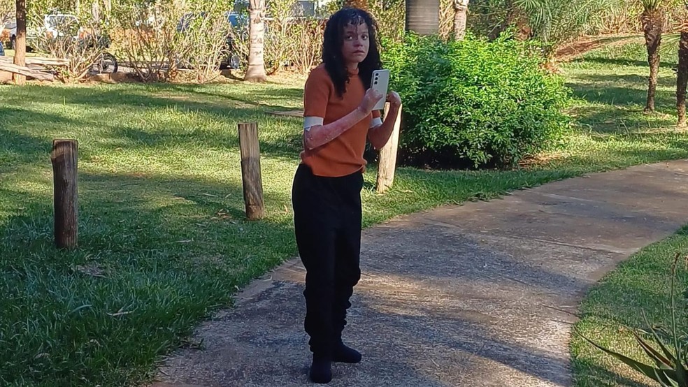 Elena Kessia Fávero é moradora de Olímpia (SP) e tem epidermólise bolhosa — Foto: Arquivo pessoal