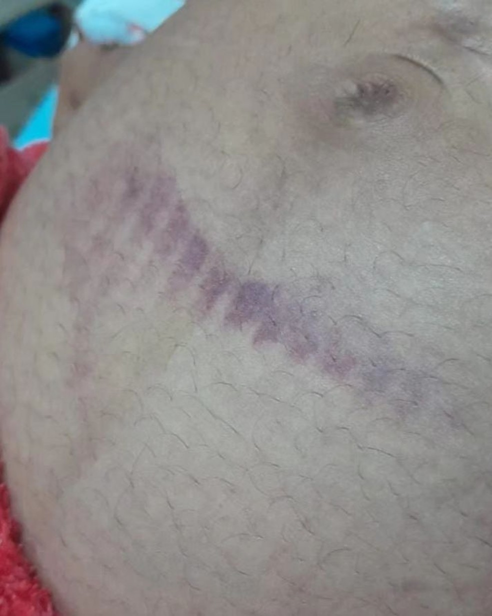 Grávida de 8 meses perde filho após ser agredida com chute na barriga no interior do MA — Foto: Divulgação