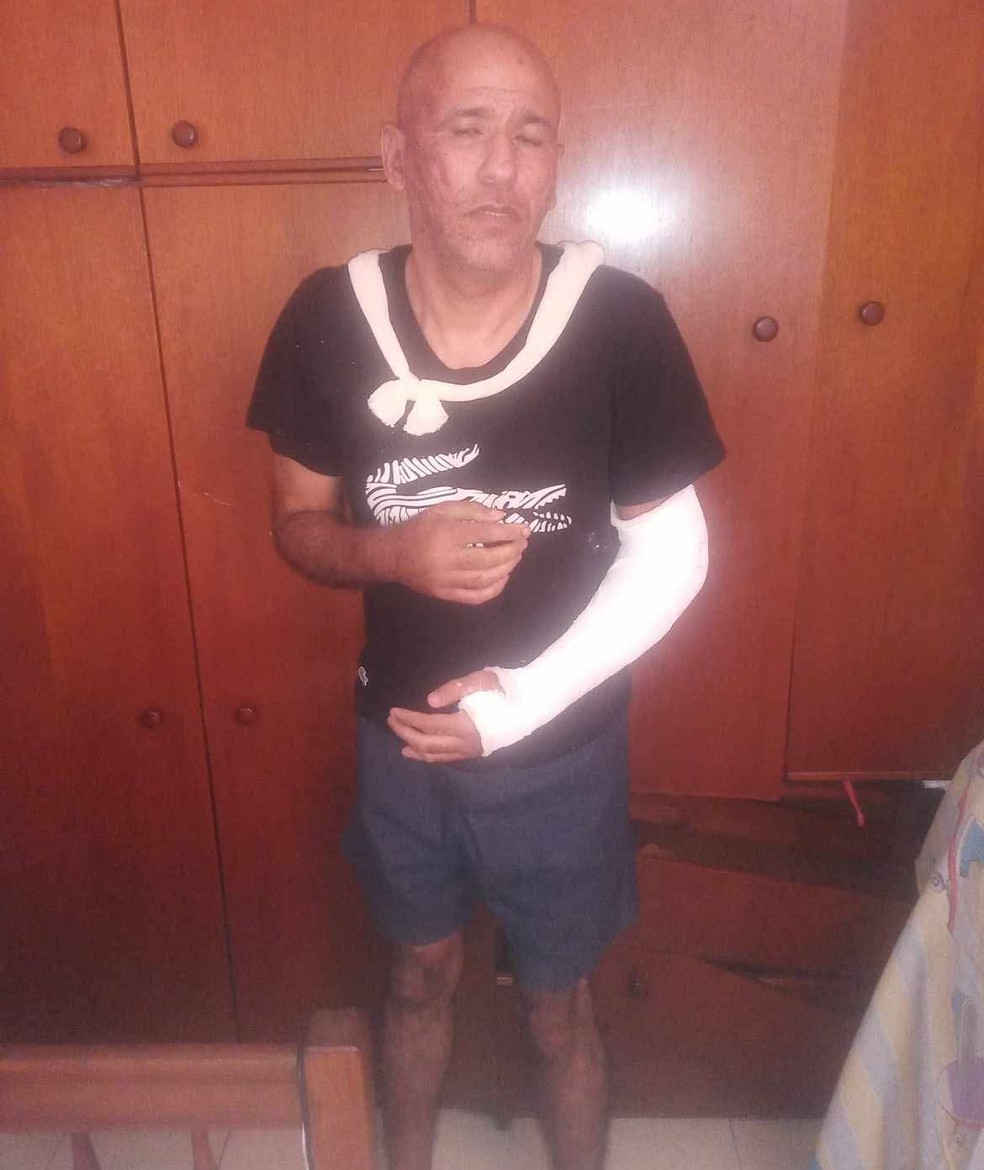Renato Medeiros, com braço enfaixado e ferimentos no rosto, em 2023, quando denunciou seu ex-chefe, o MC Poze do Rodo — Foto: Reprodução