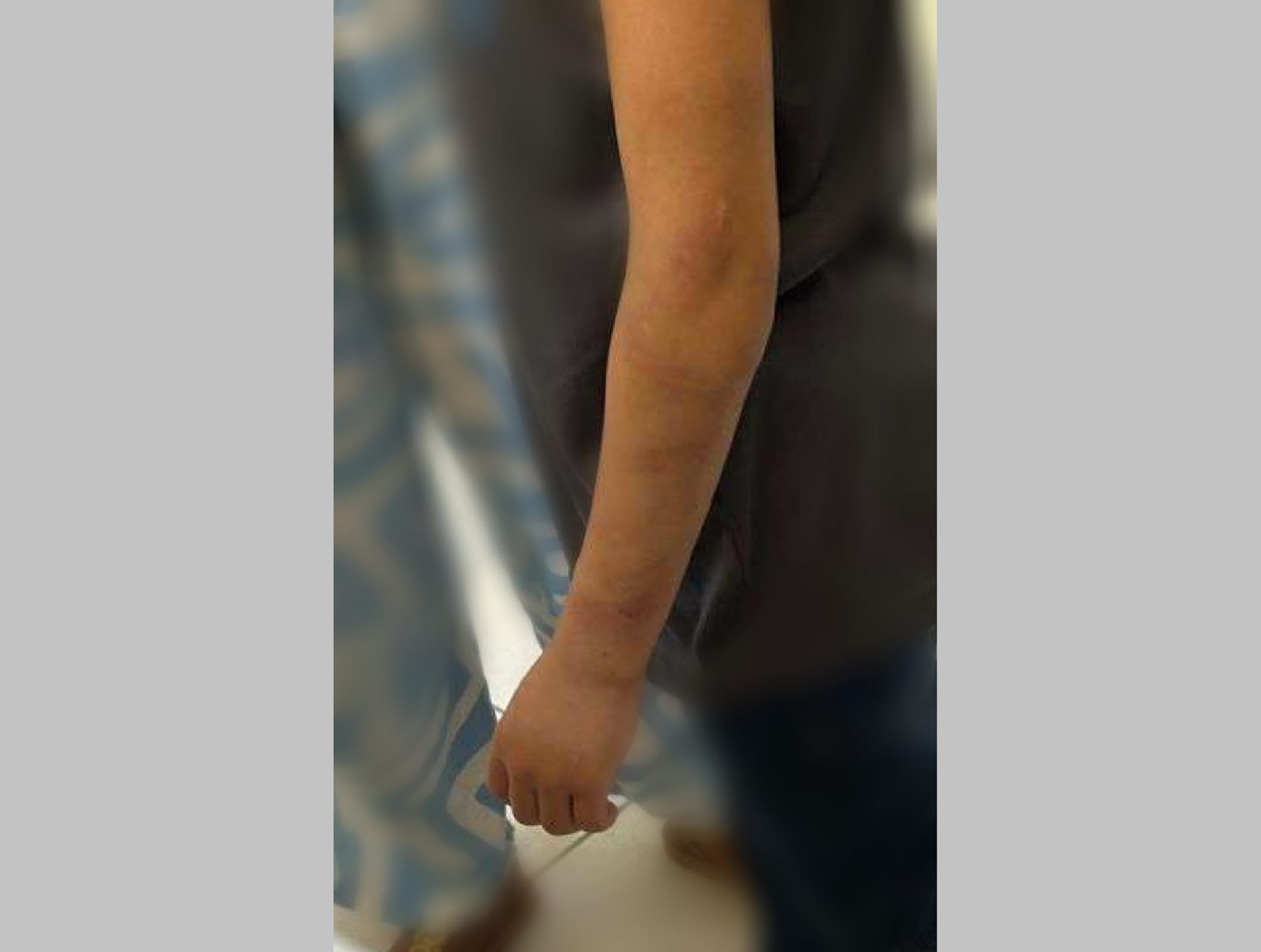 Mãe presa admite que agrediu filha de 9 anos com vários golpes de vassoura por não cumprir tarefa doméstica, diz polícia
