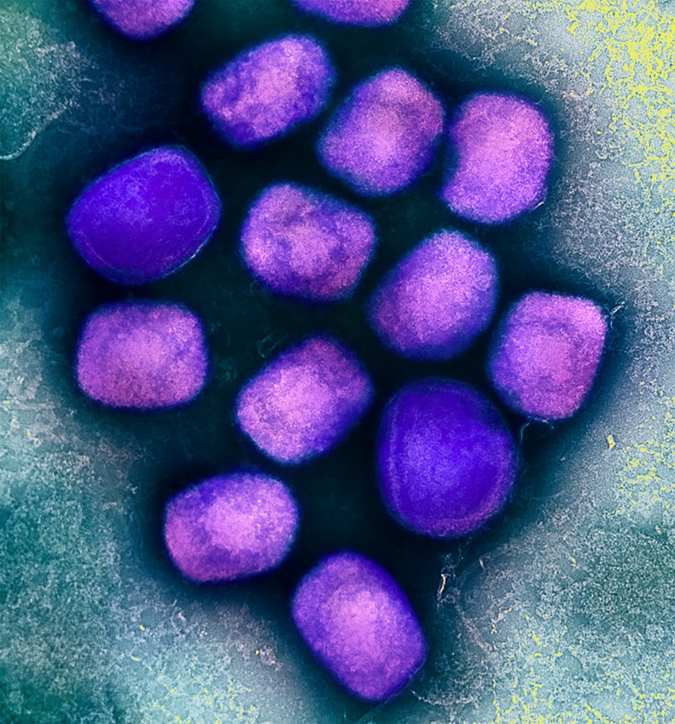 Partículas do vírus da mpox vistas em microscópio eletrônico. — Foto: NIAID