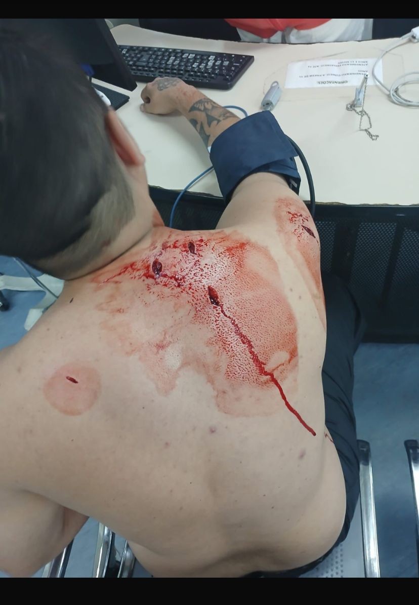 Homem chama motorista por aplicativo e tenta roubar moto com golpes de faca em Santa Cruz; polícia prende suspeito escondido
