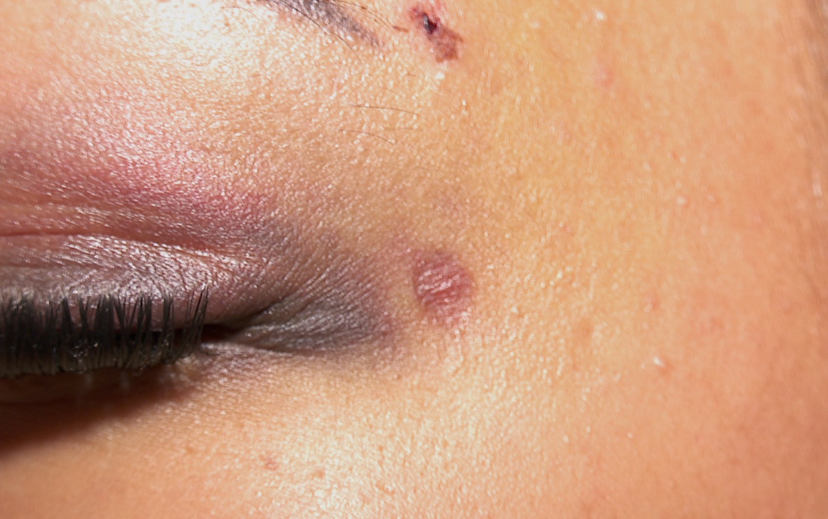 Jovem agredida por ex diz que funcionária da guarita foi omissa: 'Vê mulher sendo chutada no rosto e ainda pergunta se é pra ligar pra polícia?'