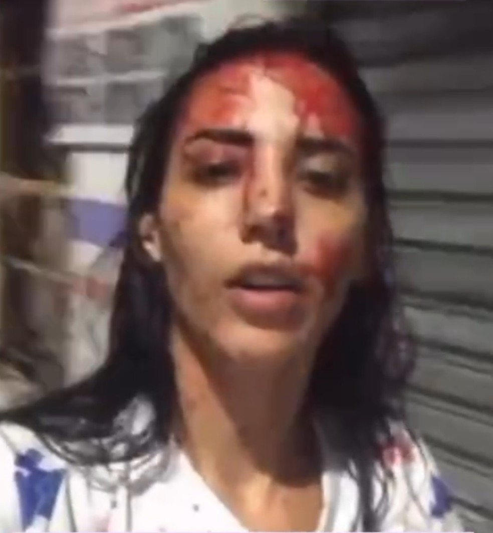 Com sangue no rosto, Bia Correia alega ser vítima de violência doméstica — Foto: Reprodução