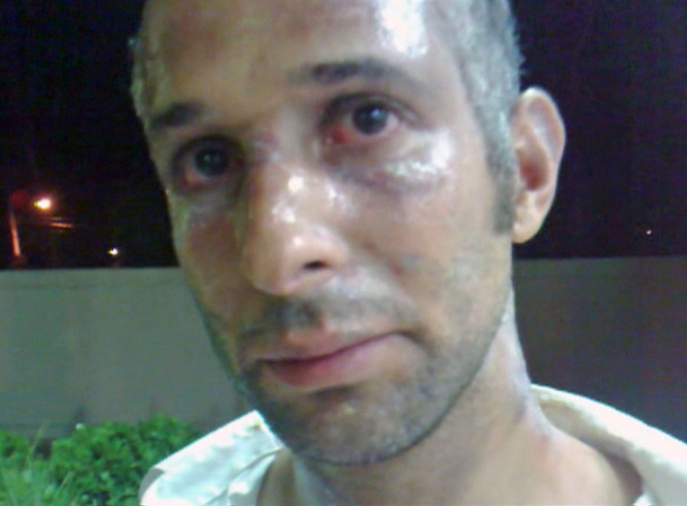Ex-marido de Veronica Costa relata tortura e queimaduras em caso polêmico