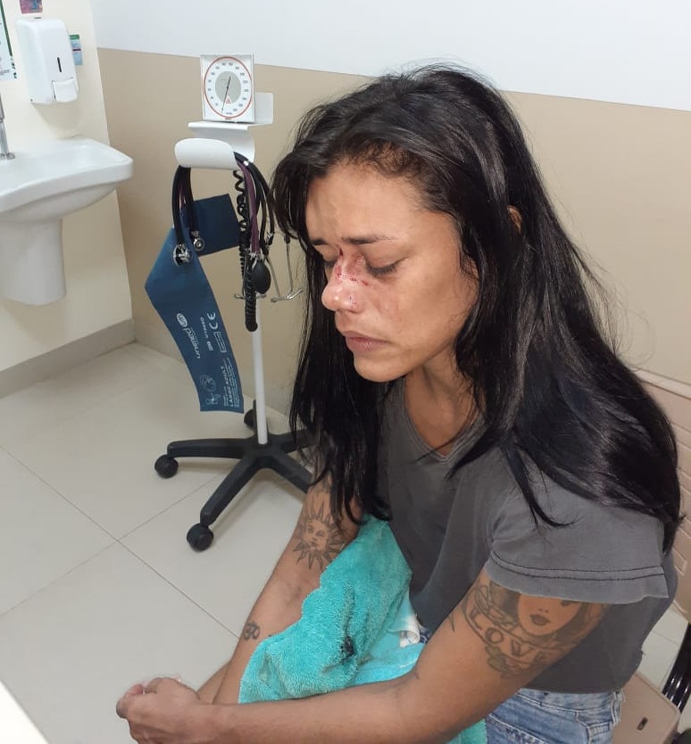 Marina Montenegro foi agredida no rosto com socos nessa segunda-feira (18) — Foto: Arquivo pessoal