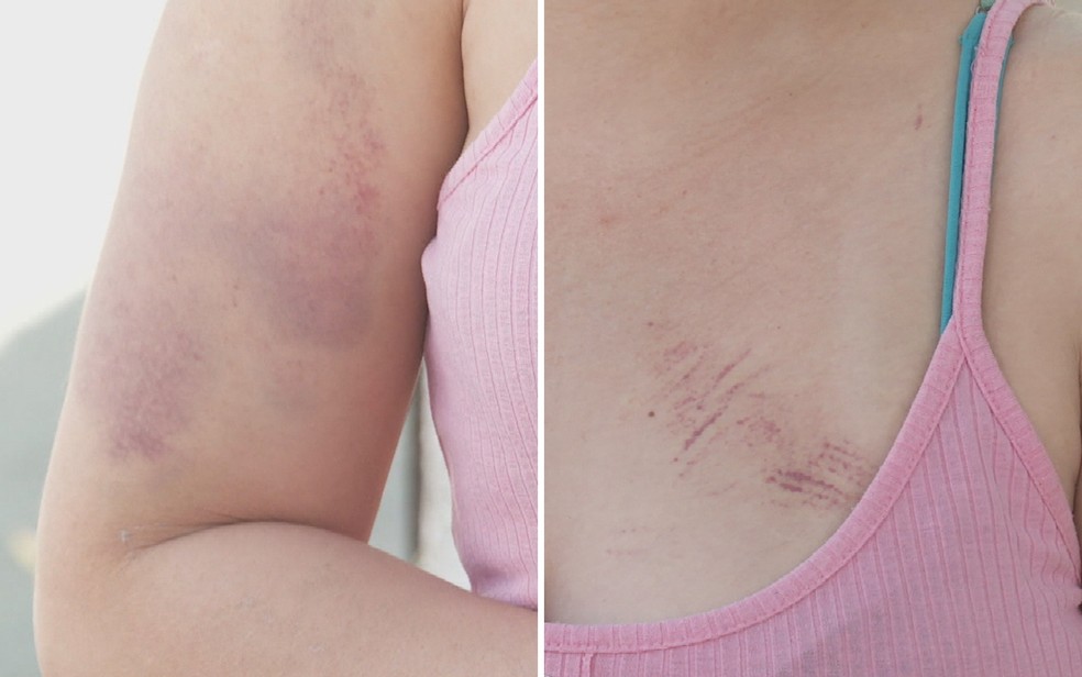 Cantora denuncia ter sido espancada pelo companheiro de dupla sertaneja em Goiânia, Goiás — Foto: Reprodução/TV Anhanguera