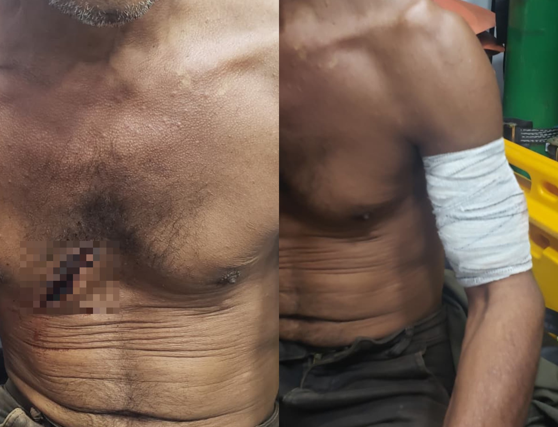 Caseiro fica ferido após ser atacado com golpes de facão em Alto Alegre